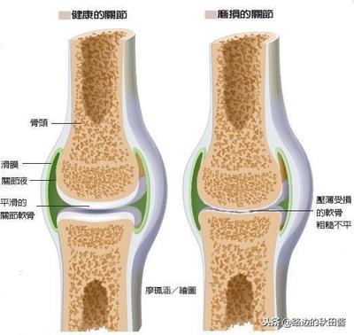 膠原蛋白對骨骼的功效與作用